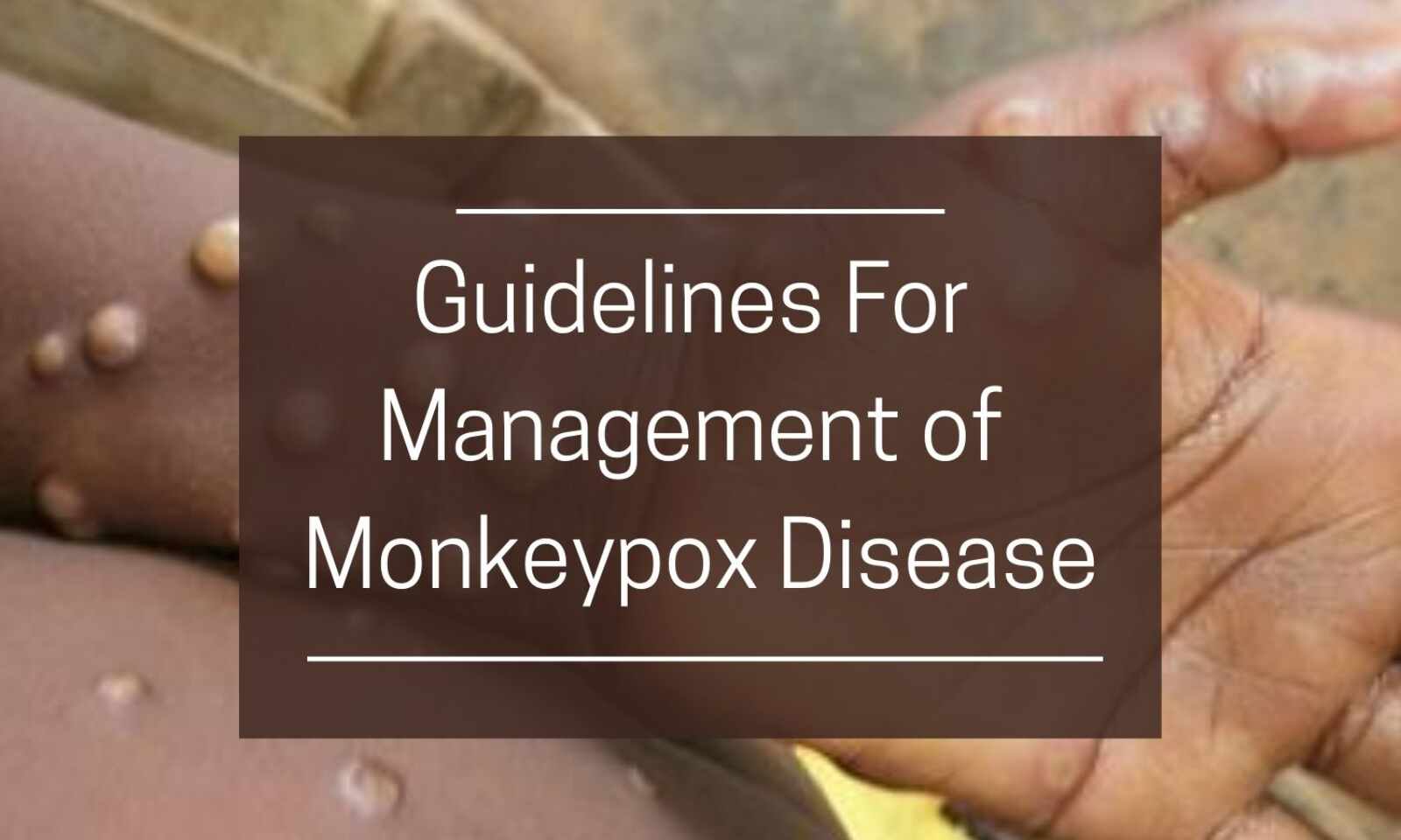 GUIDELINES OF MONKEYPOX FOR MANAGEMENT DISEASE 